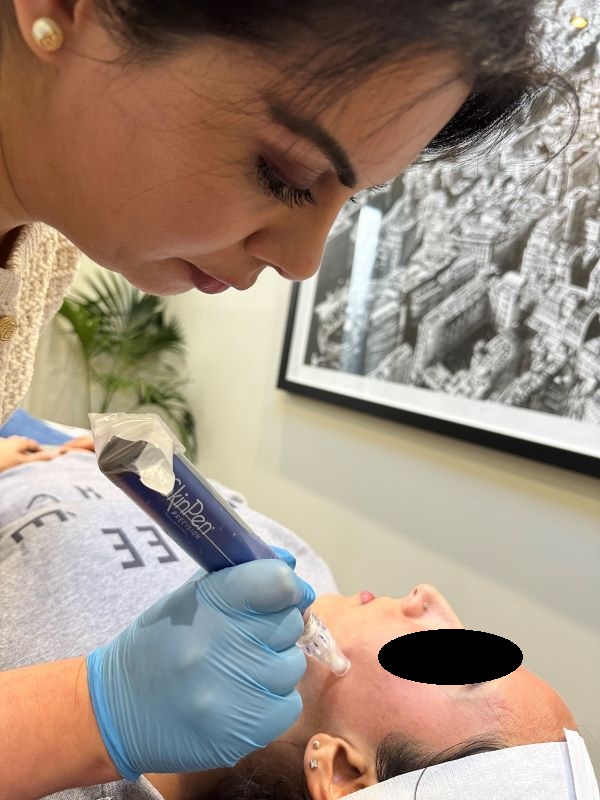 SkinPen microneedling treatment in progress at Dr Shaleen Aesthetics in Gerrards Cross, Buckinghamshire
